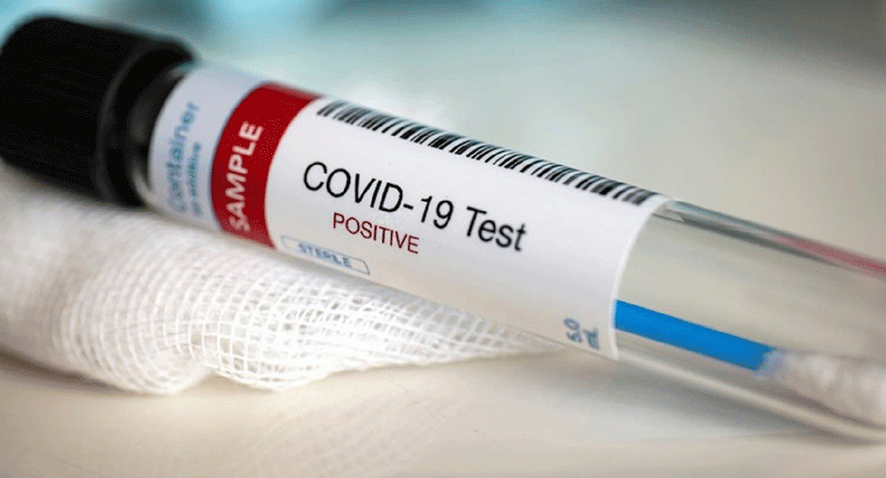 covid-19-test